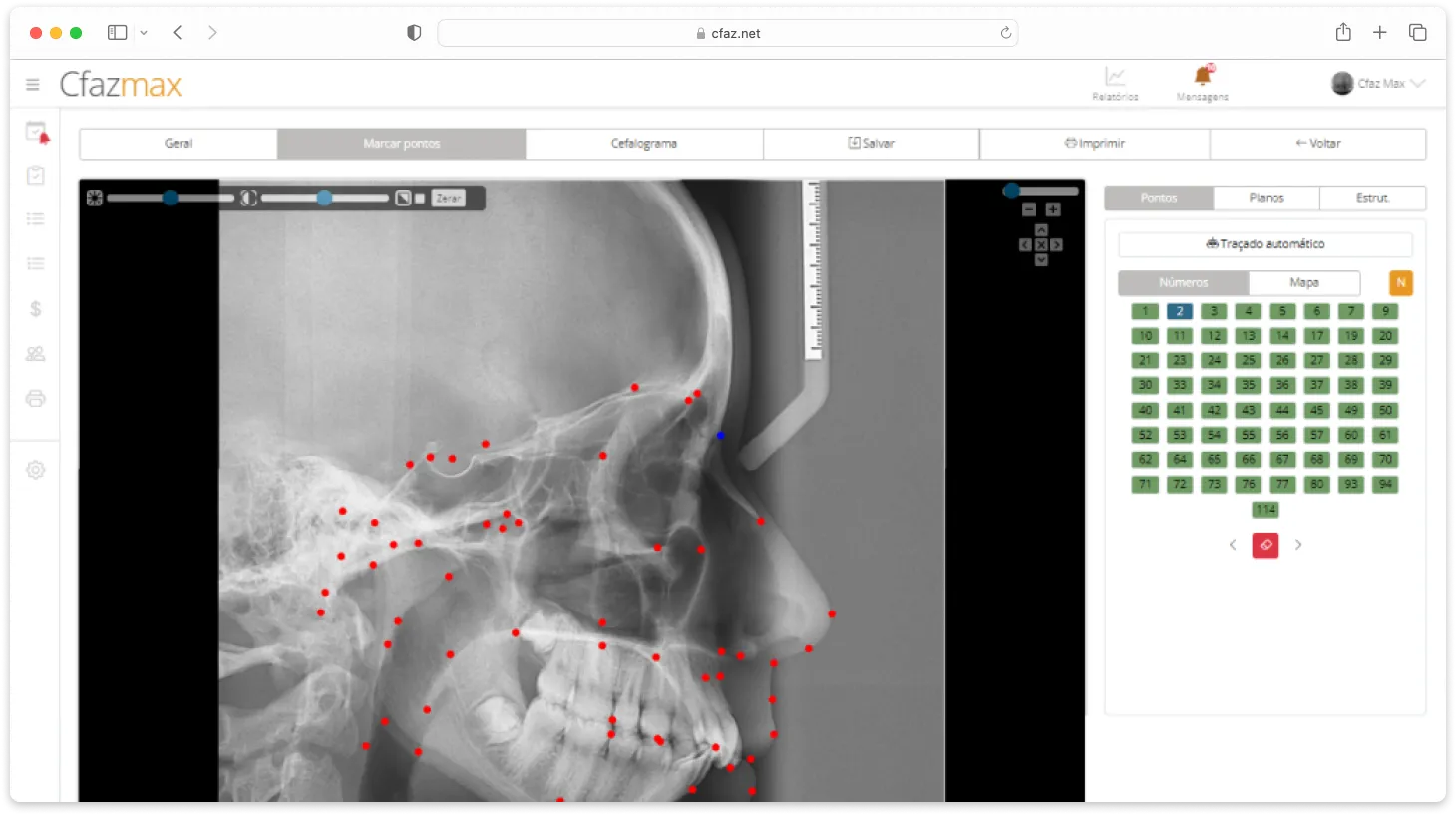 Tela do sistema Cfaz.net com um exame de cefalometria