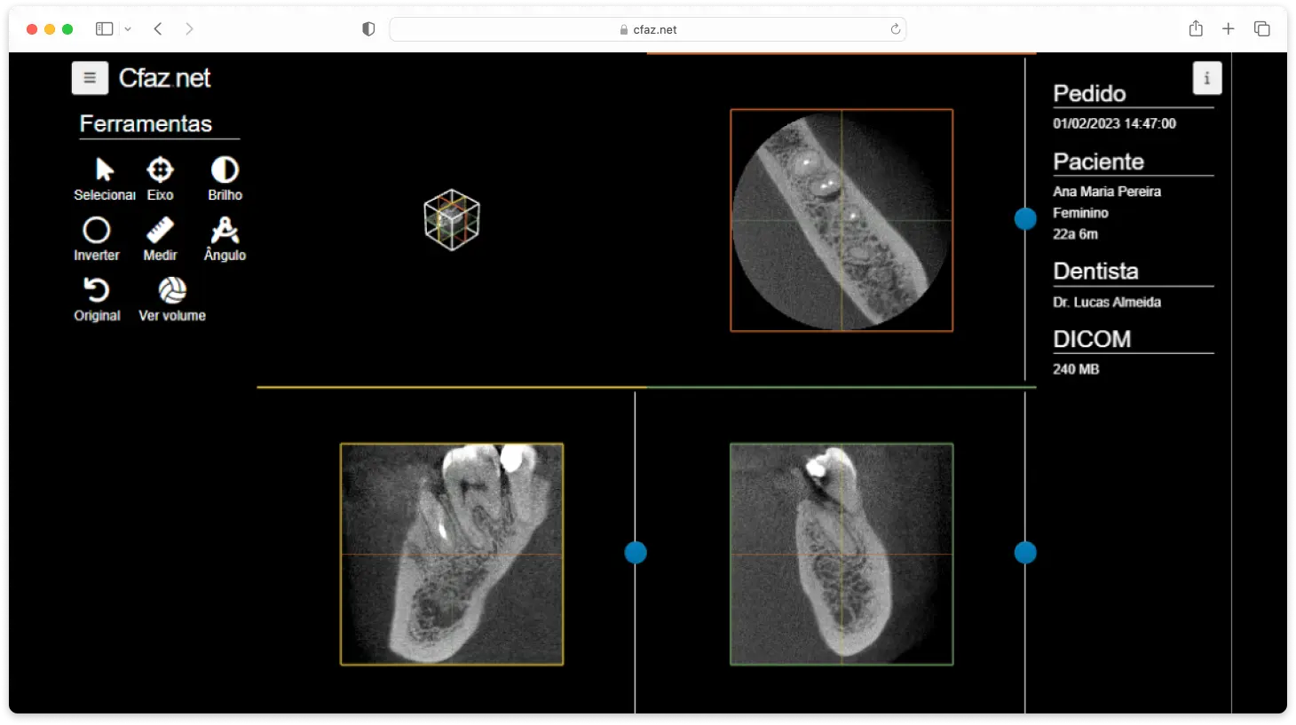 Tela do software Cfaz.net com a edição de um exame odontológico