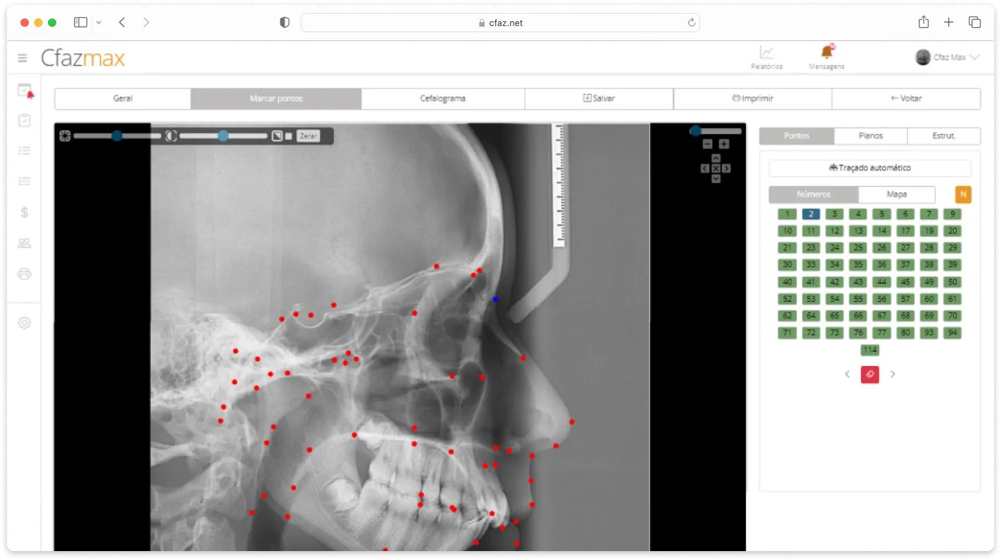 Cfaz.net system screen with a cephalometry exam